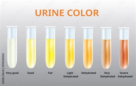 cantitate mica de urina|Sumar de urină: 6 cauze pentru densitate urinara mica